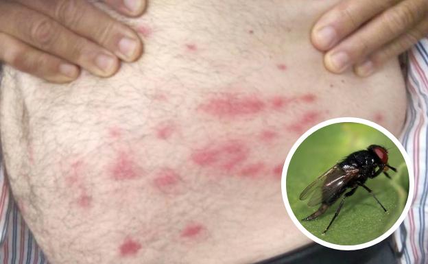 ¿Qué es la mosca negra?
