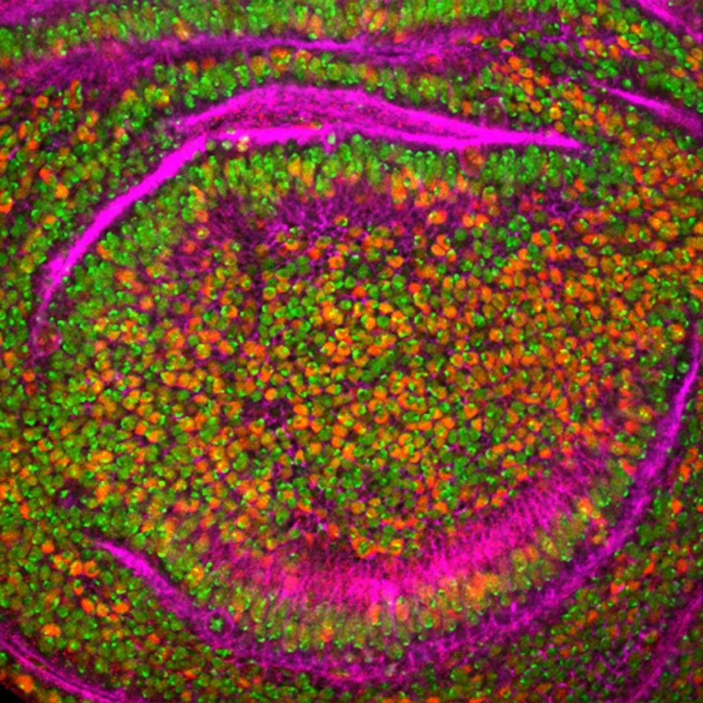 Síntomas del cáncer testicular que avisan del peligro 1 Vida.es Síntomas del cáncer testicular que avisan del peligro