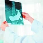 Los síntomas del cáncer de páncreas que no debes ignorar