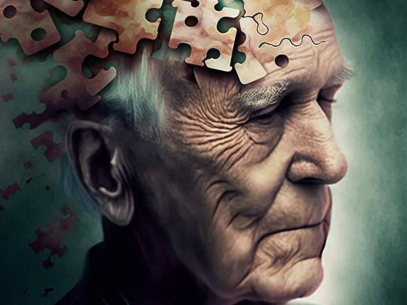 ¿Por qué hay más mujeres afectadas por la enfermedad de Alzheimer? 