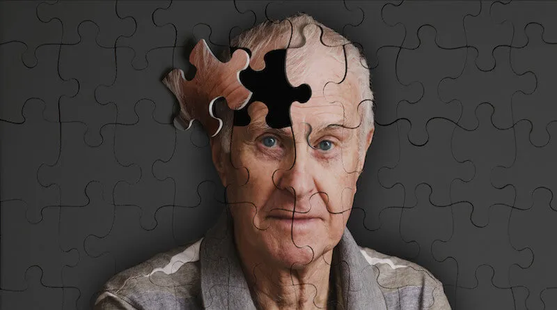 ¿Es posible prevenir la demencia?
