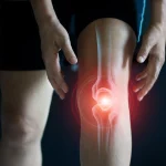 Dolor de rodillas: así puedes combatirlo eficazmente
