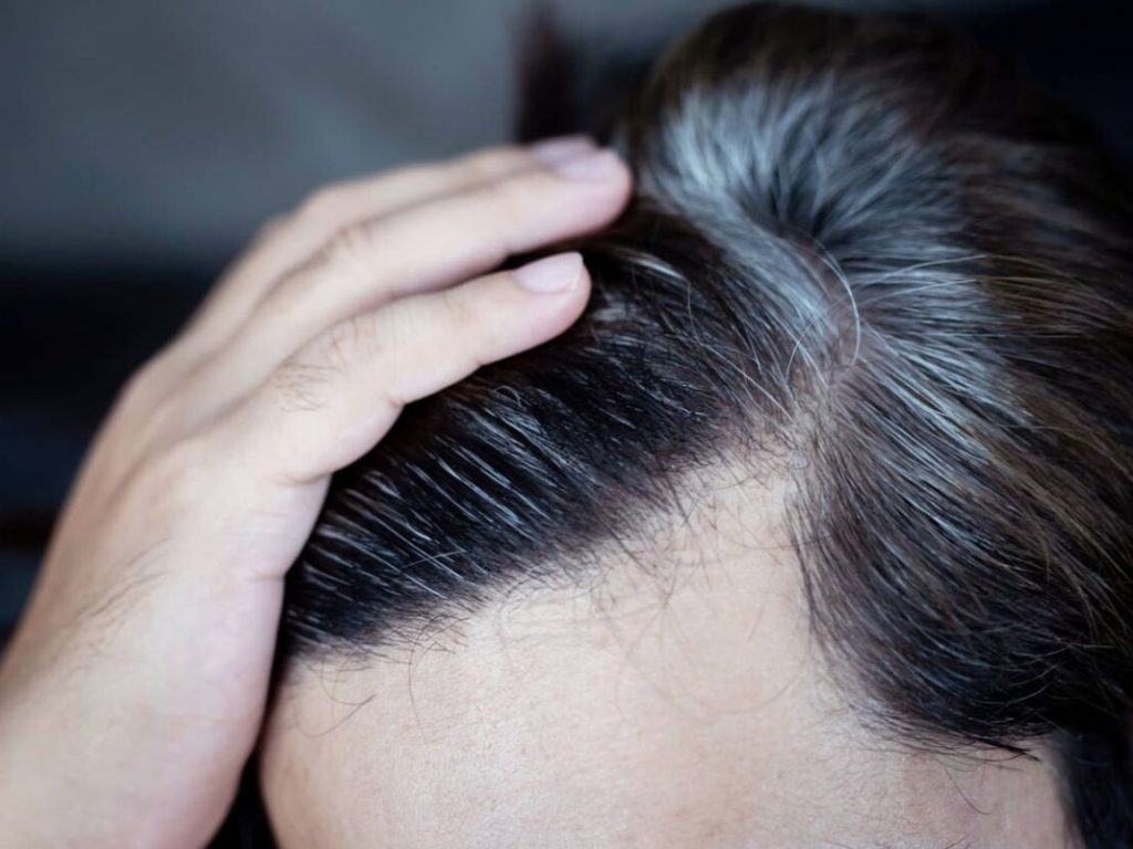 Causas de las canas 