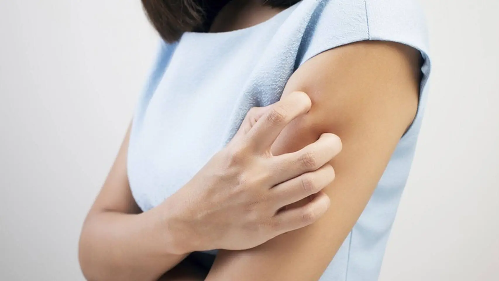 ¿Qué es la urticaria?