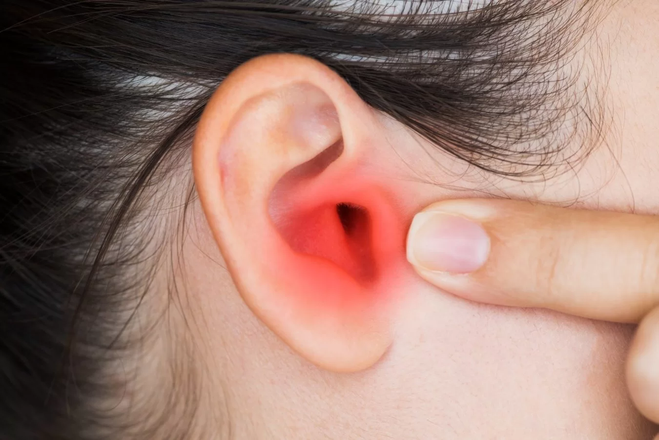 ¿Cómo se pueden prevenir las infecciones de oído primaverales?