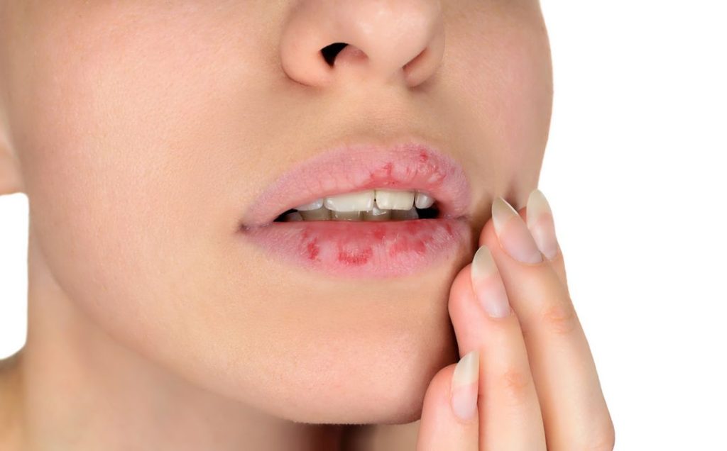 Cómo evitar tener los labios cortados en otoño 1 Vida.es Hidratación esencial