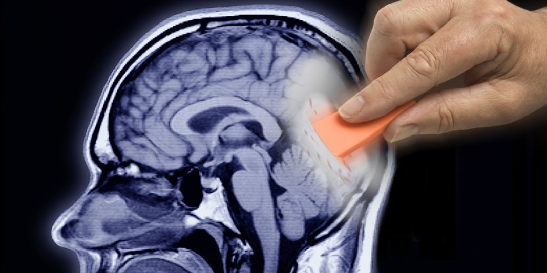 Alzheimer: cómo reconocer los primeros signos y retrasar su progreso 2 Vida.es El papel de la nutrición y el ejercicio