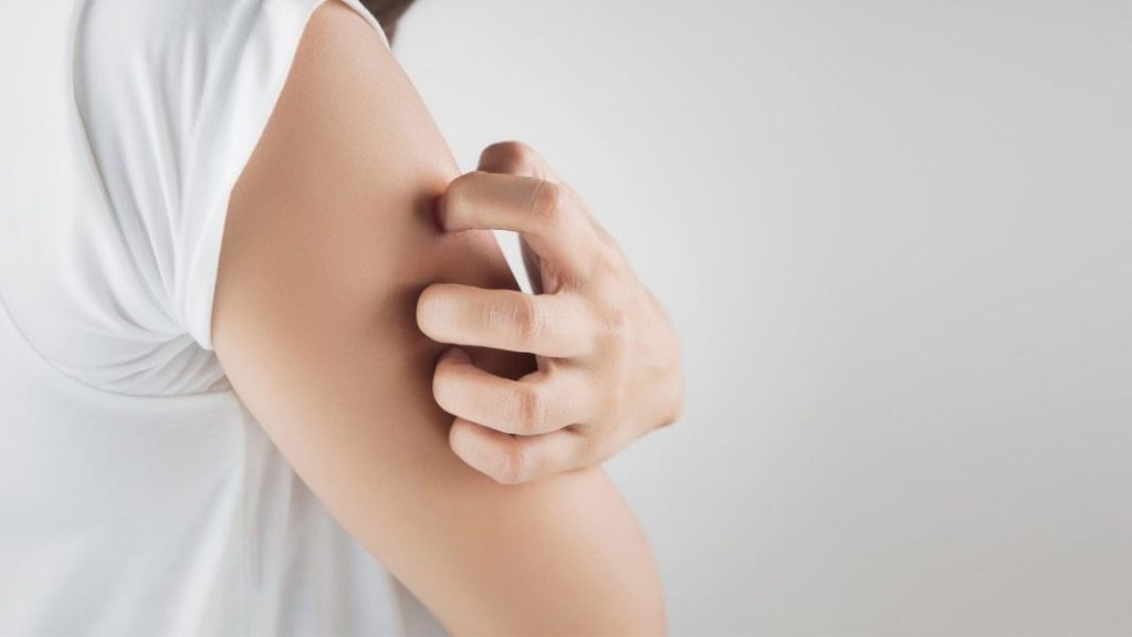 Hidratación, clave para prevenir el picor