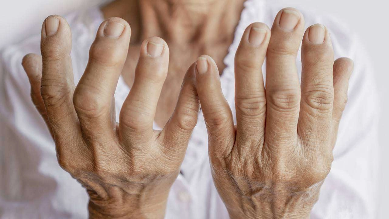 Artritis después de los 60: Guía para combatir el dolor y vivir mejor 2 Vida.es NUTRICIÓN PARA LAS ARTICULACIONES