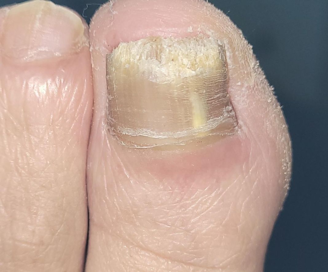 EL PAPEL DEL MANTENIMIENTO DE LAS UÑAS