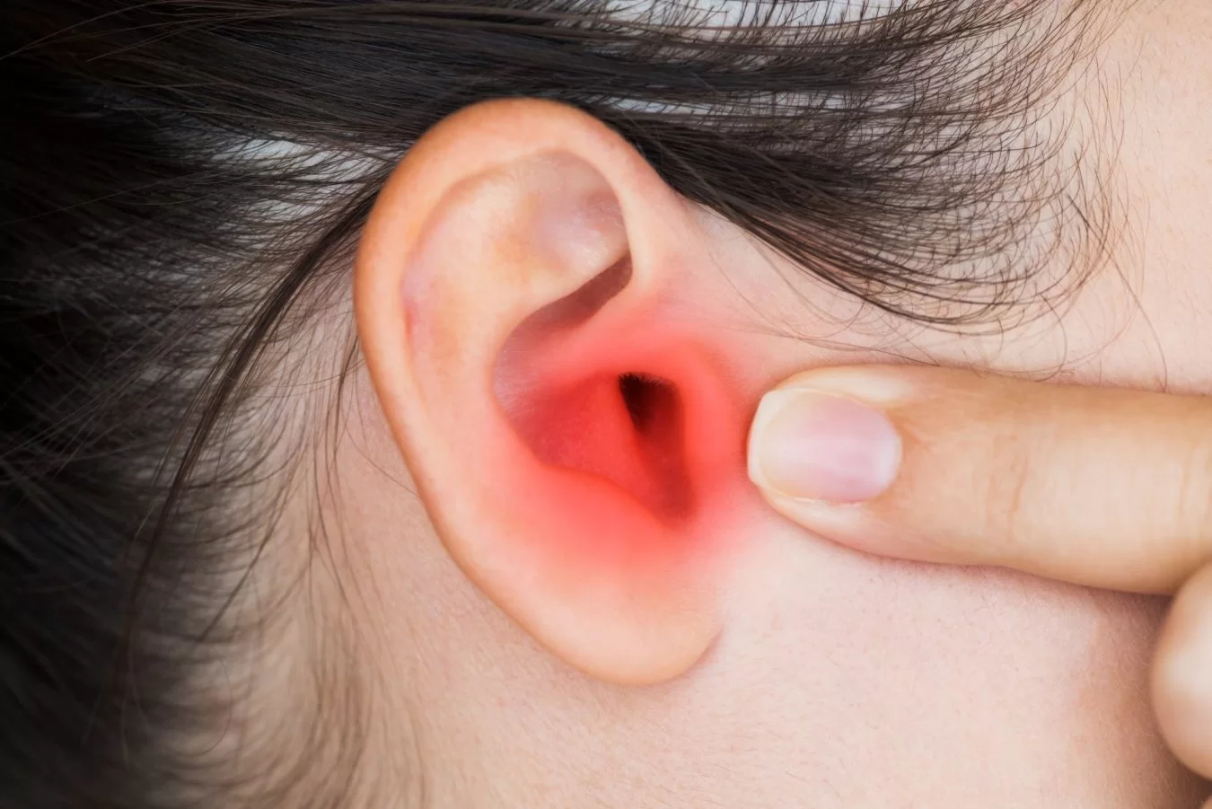 PREVENCIÓN DE LAS INFECCIONES DE OÍDO