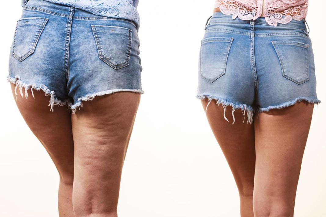 Combate la celulitis con esta dieta revolucionaria: ¡Resultados que no creerás! 3 Vida.es ROL DE LAS HORMONAS