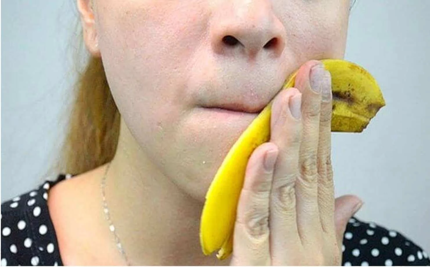 VERRUGAS: CÓMO APLICAR LA CÁSCARA DE PLÁTANO