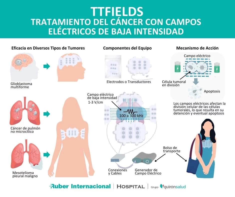 Avances en el Tratamiento del Cáncer: Terapia con Campos Eléctricos para el Tratamiento de Tumores (TTFields) en el Hospital Ruber Internacional 1 Merca2.es ruber 1 Merca2.es