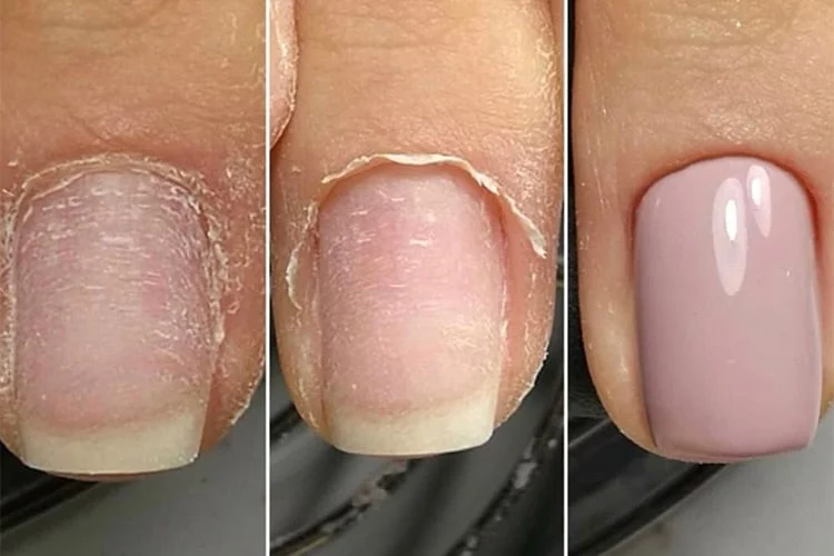 La OCU advierte sobre la manicura rusa conoce los riesgos antes de decidirte 2 Vida.es HIGIENE Y ESTERILIZACIÓN: FACTORES CLAVE EN LA MANICURA RUSA