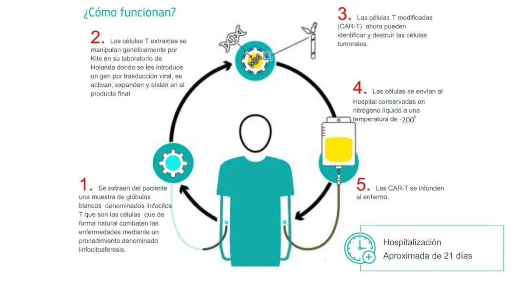 CAR-T Cell terapia avanzada para el tratamiento de pacientes hematológicos 1 Vida.es La terapia CAR T linfocitos T con receptores antigenicos quimericos por sus siglas en ingles Vida.es