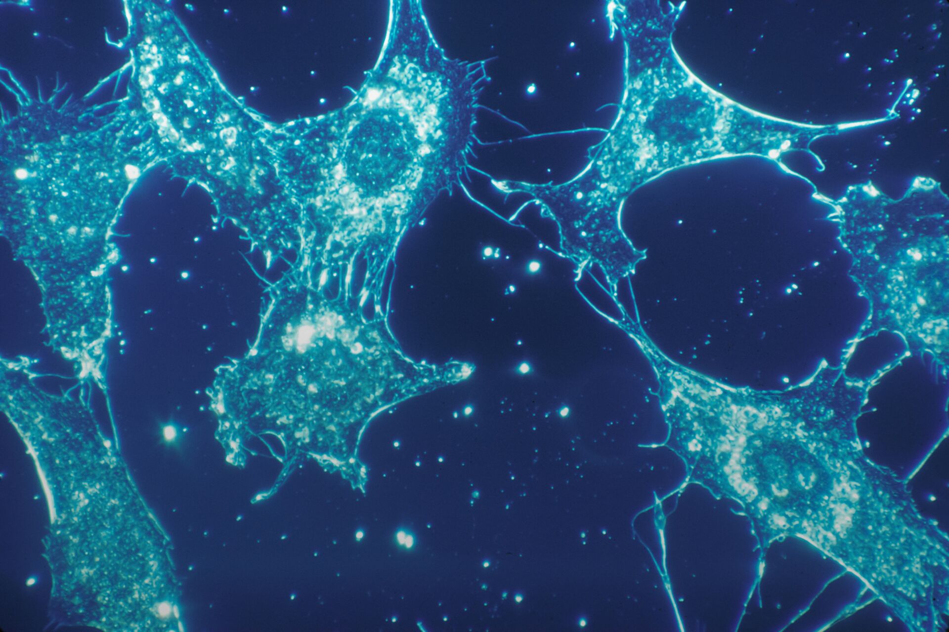 Un estudio preliminar apunta que la Viagra podría frenar la metástasis del cáncer 1 Vida.es sildenafilo cancer