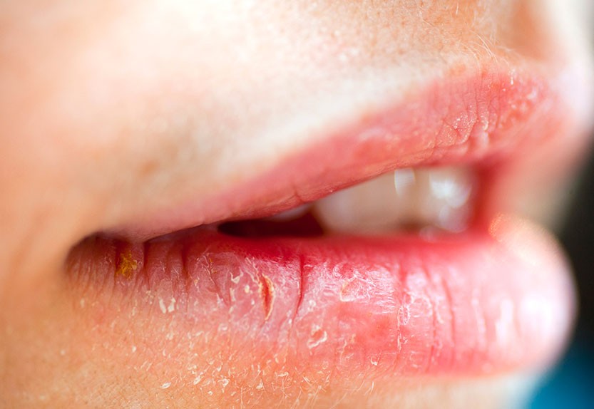 Los labios son la parte más sensual del rostro de una mujer