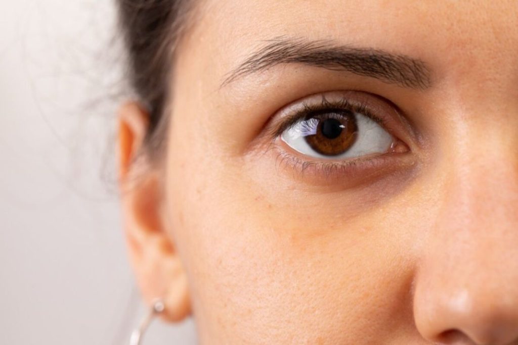 ¿Cómo se forman las ojeras?