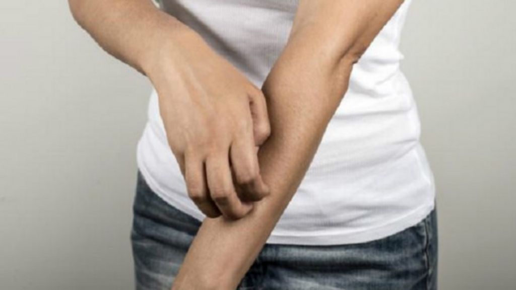 ¿Qué complicaciones puede causar la urticaria?