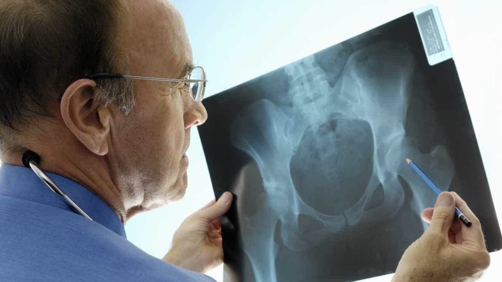Terapia con células madre