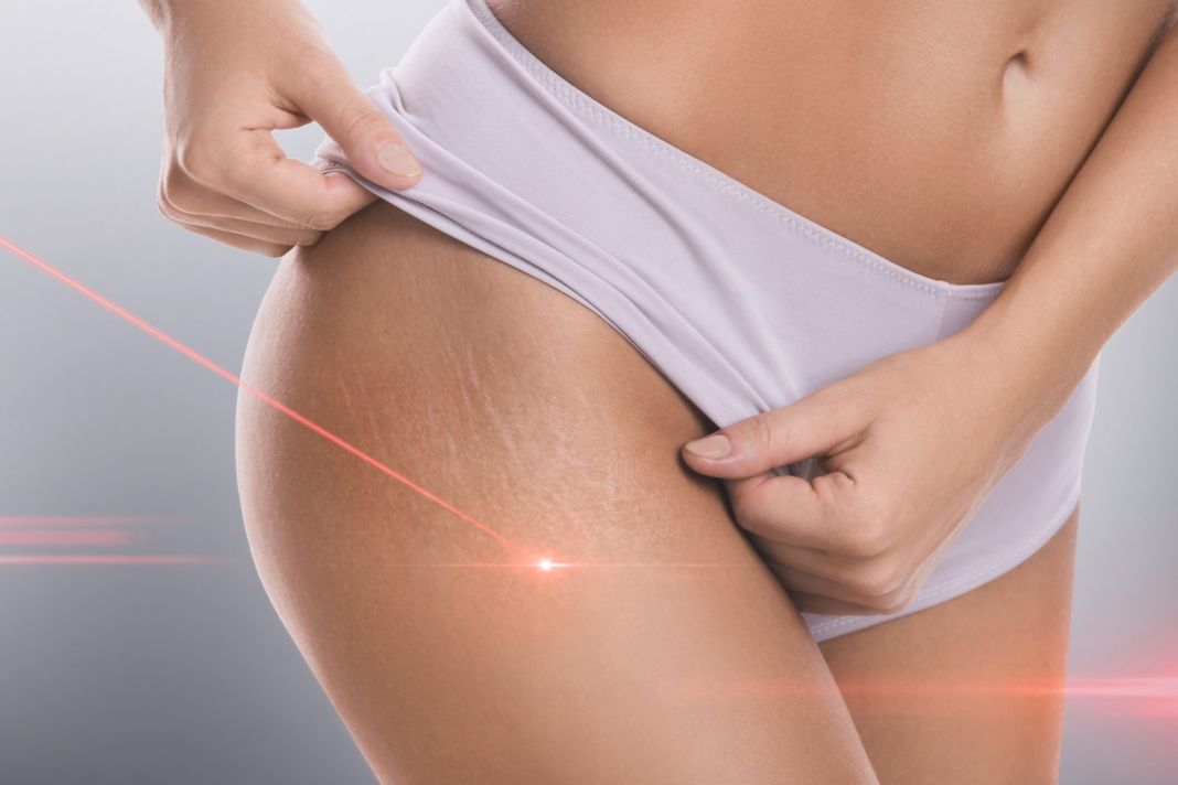 Terapia láser de pulsos cortos