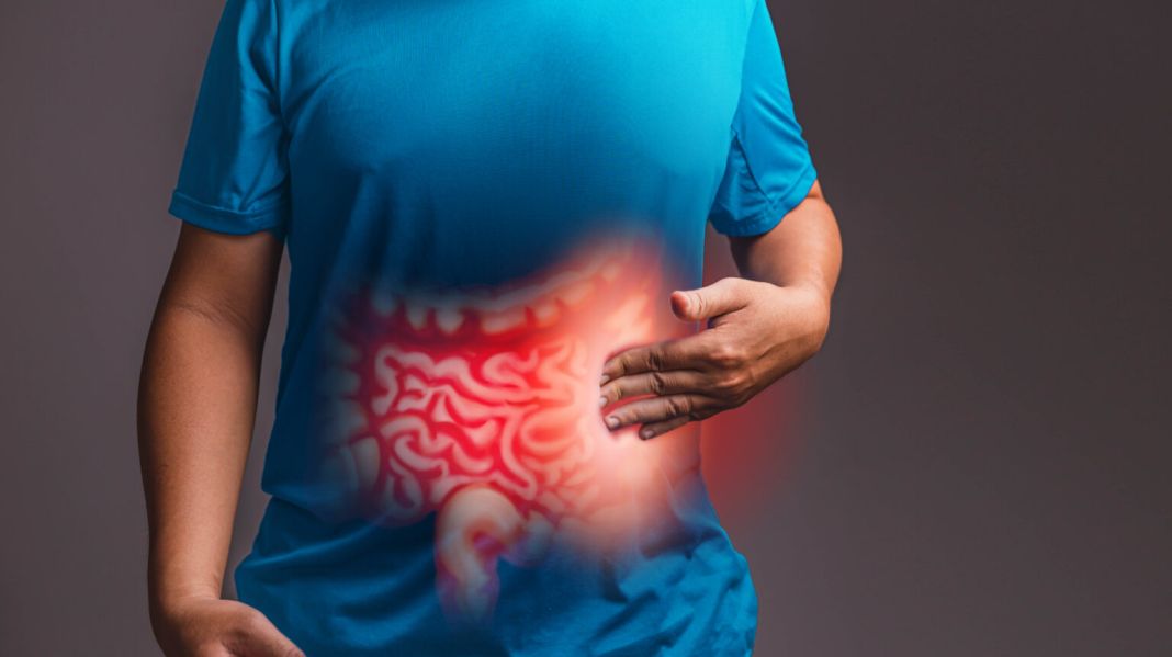 COMPRENSIÓN DE LA SALUD INTESTINAL