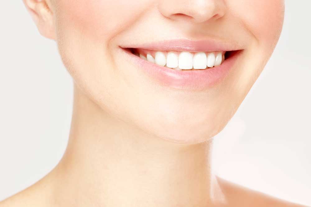 Dientes blancos