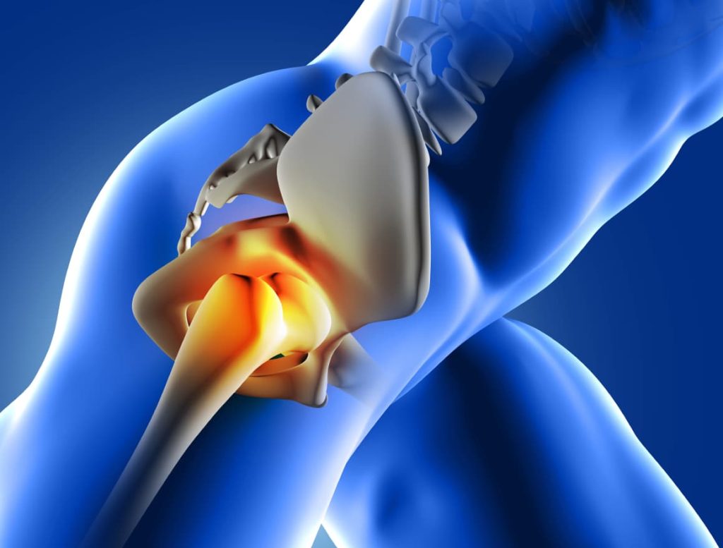 Reducción del dolor articular