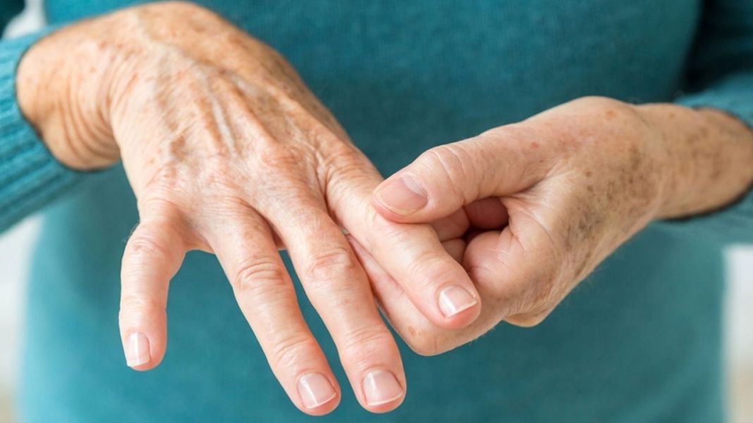ARTRITIS: COMPRENDER LA ARTRITIS EN LA VEJEZ