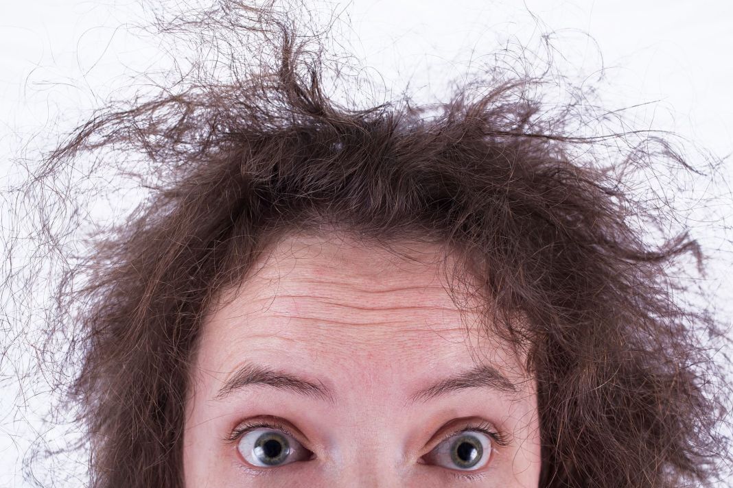 SOLUCIONES NATURALES, ¡ADIÓS FRIZZ!