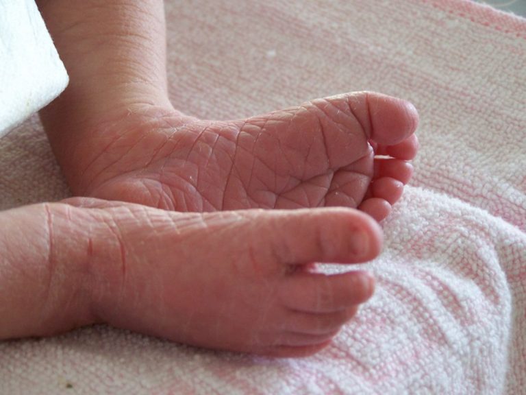 Cuidado adecuado para la piel seca en bebés y niños pequeños