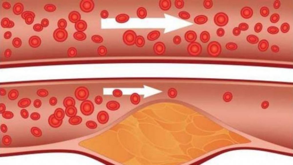 Colesterol bueno vs malo: cuál es cuál y en qué se diferencian 1 Vida.es ¿Qué es el colesterol?