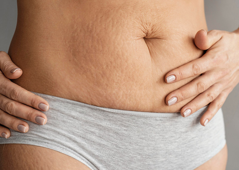Mercadona tiene el producto que te hará perder grasa corporal por la noche 1 Vida.es Mercadona tiene el producto que te hará perder grasa corporal por la noche