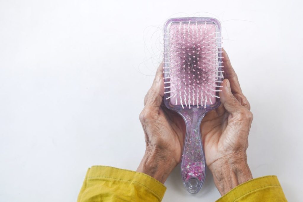 Otros problemas en el pelo que puedes tener además de la alopecia 1 Vida.es salud