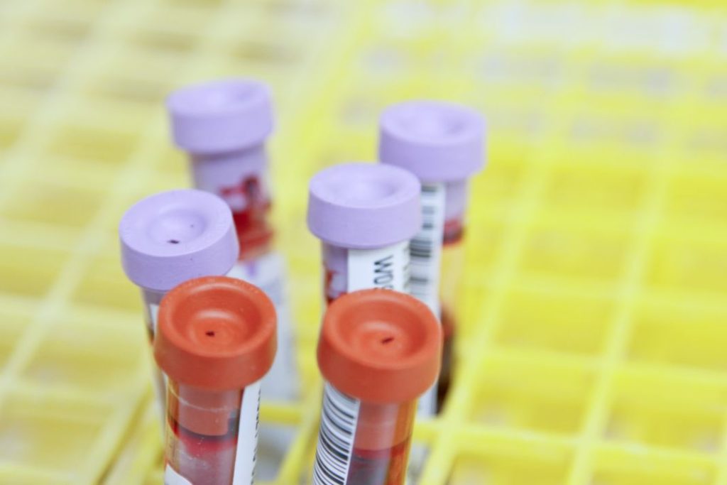 Actualizamos los tipos de sangre que puedes tener 1 Vida.es Actualizamos los tipos de sangre que puedes tener