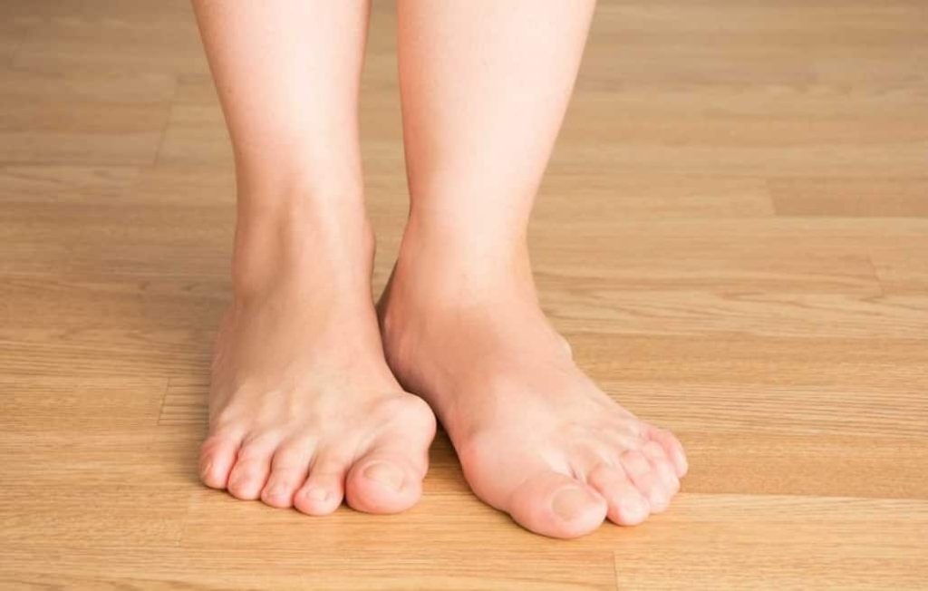 Remedios caseros para eliminar los juanetes 1 Vida.es Remedios caseros para eliminar los juanetes