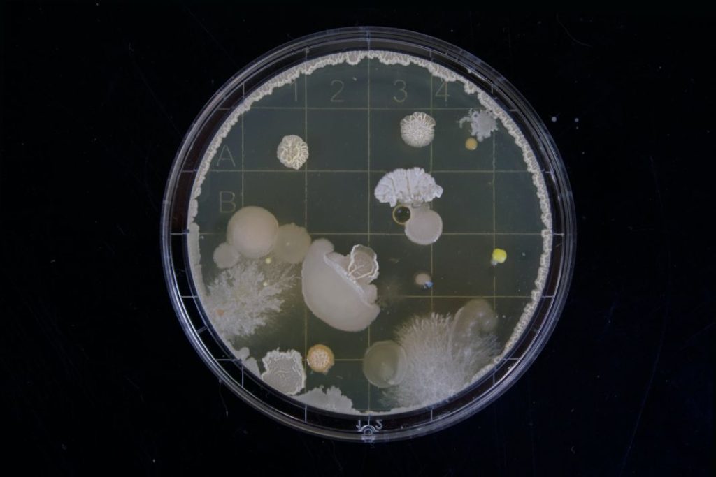 Resistencia a los antibióticos qué hacer para evitarlo 1 Vida.es Resistencia a los antibióticos qué hacer para evitarlo