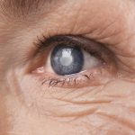 Cómo prevenir las enfermedades oculares más comunes en la tercera edad
