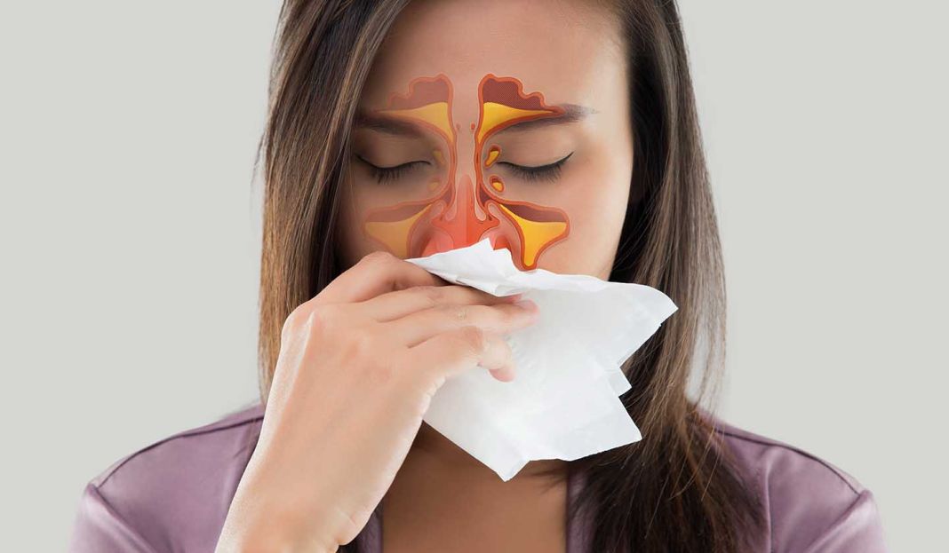 ¿Qué son las alergias primaverales?