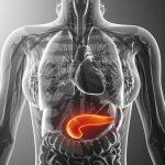 Cáncer de páncreas: 5 síntomas que no debes ignorar