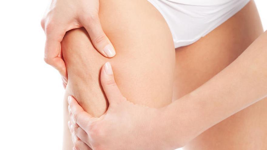 Remedios caseros que te ayudan a combatir la celulitis  1 Vida.es 9 de cada 10 mujeres mayores de 20 años sufren de celulitis