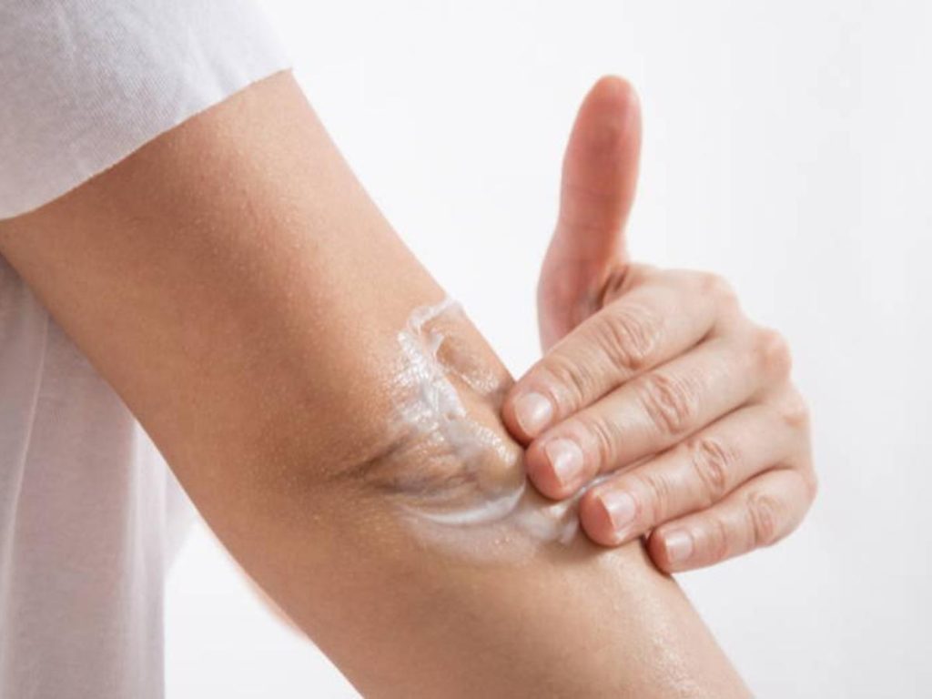 Remedios caseros para evitar la resequedad de los codos 1 Vida.es Puntos ásperos