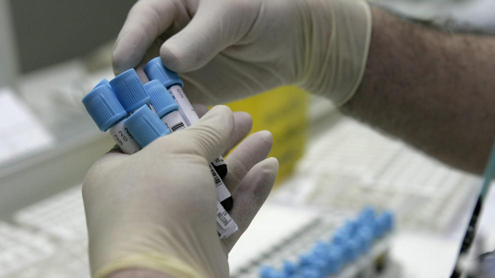 Cómo saber qué tipo de sangre eres 1 Vida.es Qué es la sangre y por qué es importante conocer su tipo