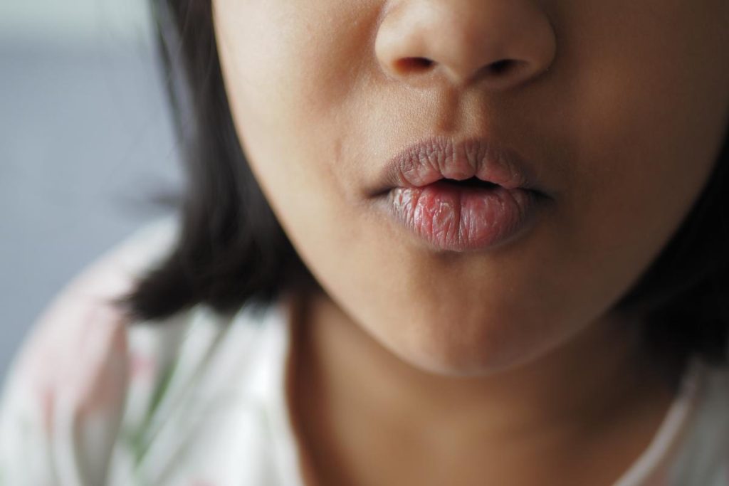 Definición y características de los labios morados